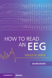 How to Read an EEG